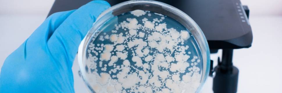 Saiba mais sobre as principais análises laboratoriais em pescado